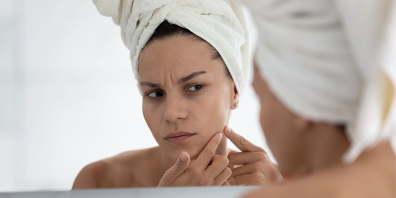 Folliculitis and Stress-Related Conditions: A Deep Dive