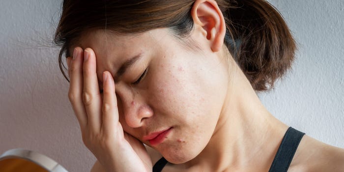 Using Warm Compress for Relief from Folliculitis: Essential Tips for Beauticians
