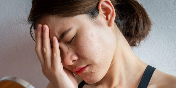 Understanding Folliculitis on Scalp Symptoms: A Guide for Beauticians