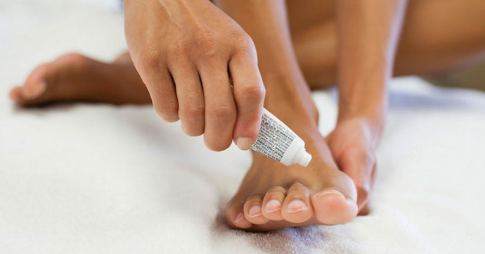 Terrific Insights on What Antifungal is Best for Athlete's Foot