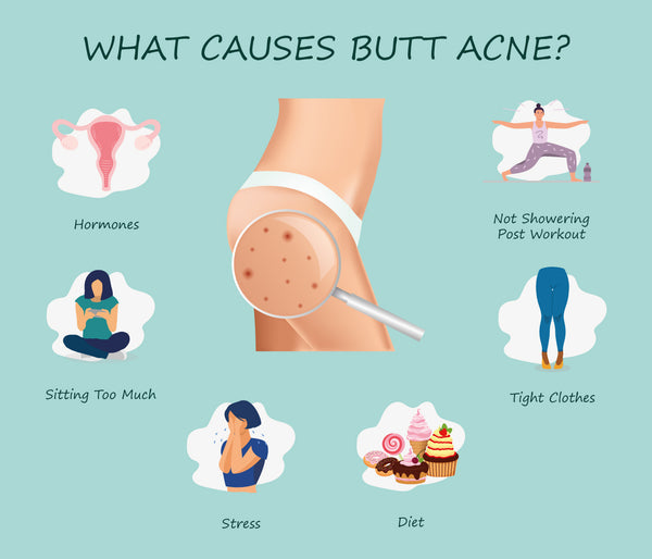 How to Get Rid of Butt and Thigh Acne? Approved Tremendous Tips