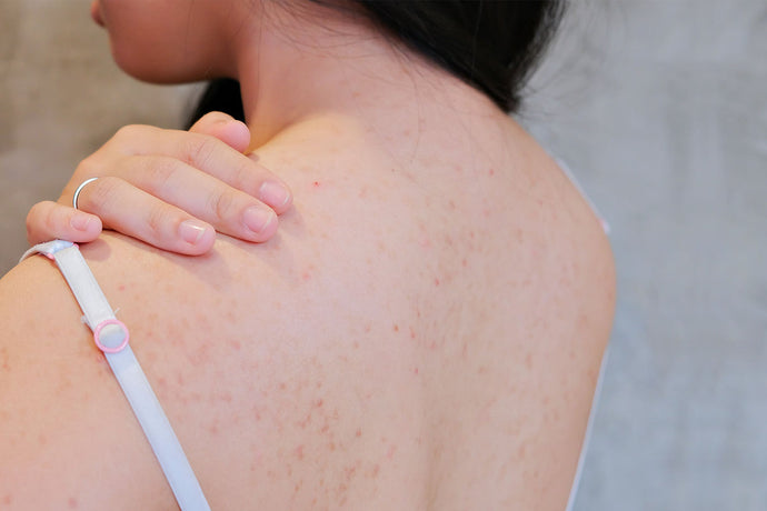 Importance of Layering Skincare After Body Wash