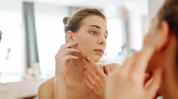 Prescription Medications for Folliculitis: Beautician's Guide