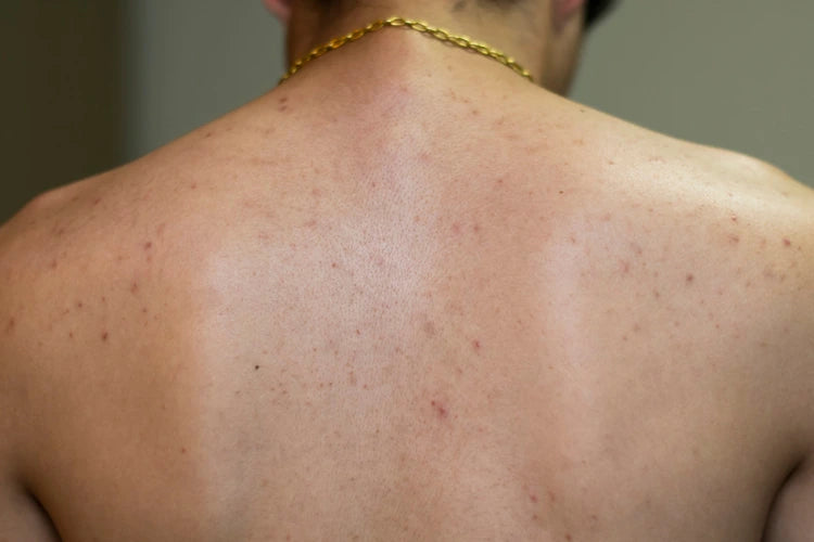 Gym Skincare Essentials for Beauticians: Must-Know Tips
