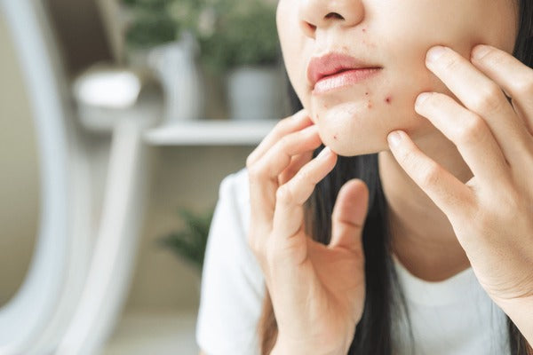Back Folliculitis Appearance and How It Affects Skin Perception